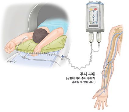조영제 주사